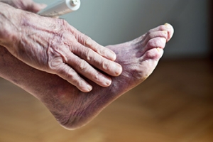 Several Reasons for Poor Circulation in the Feet